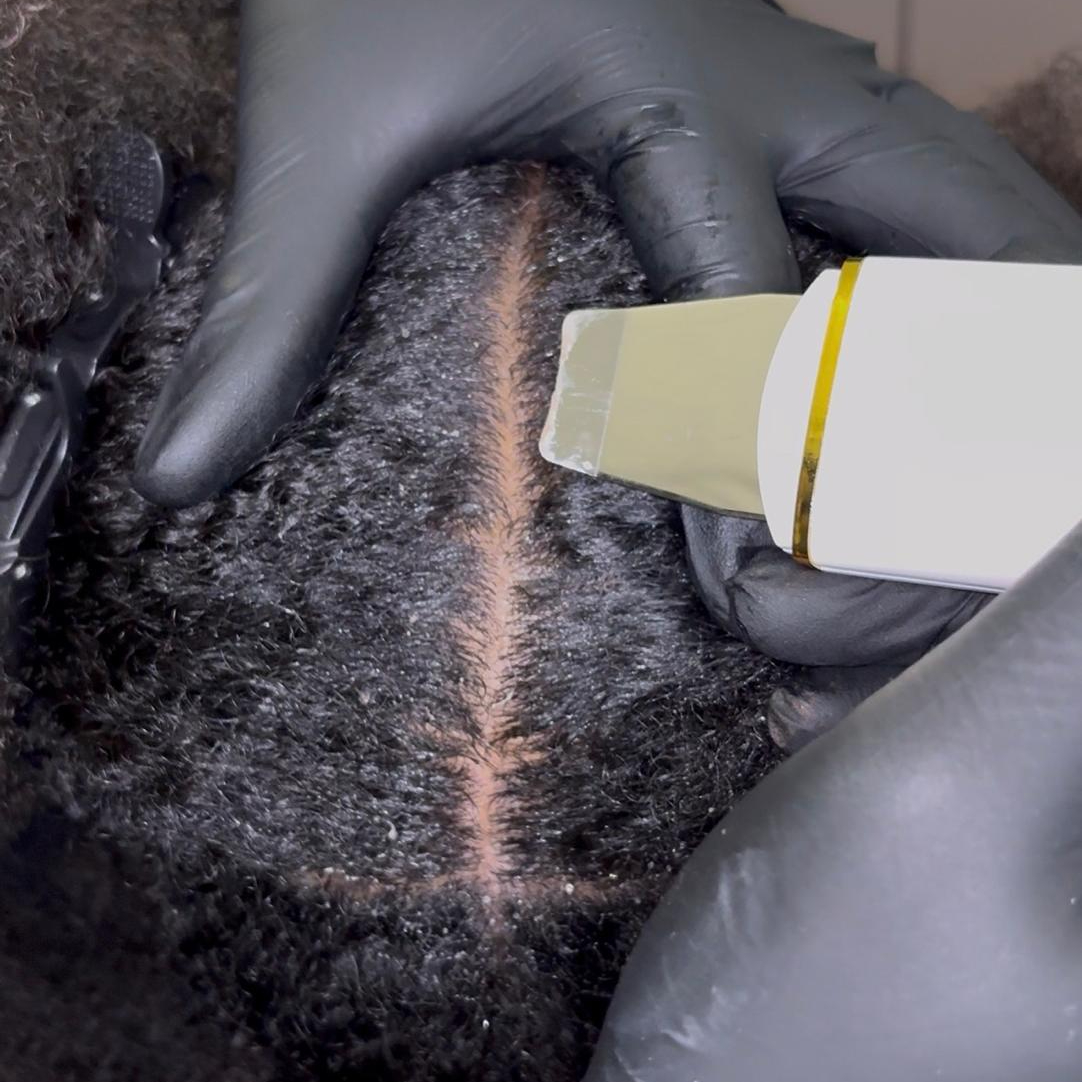 Scalp Détox Thérapy Premium