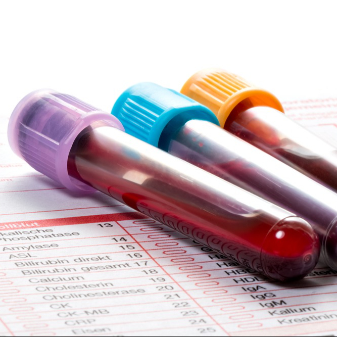 odběry - krev, moč atp.