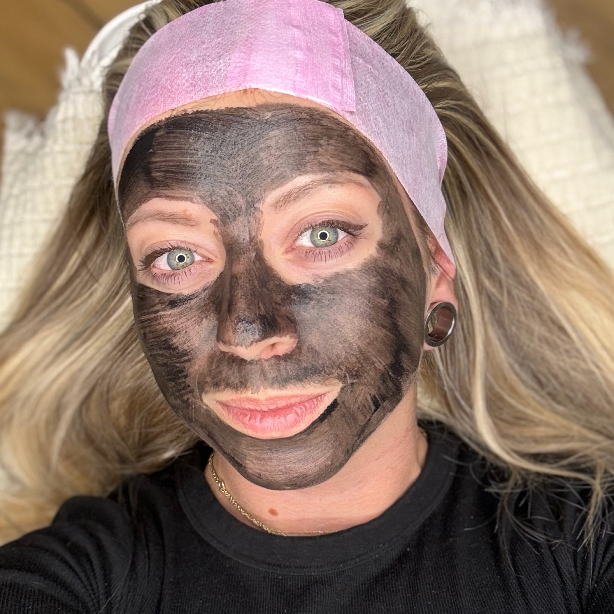 Carbon Peel