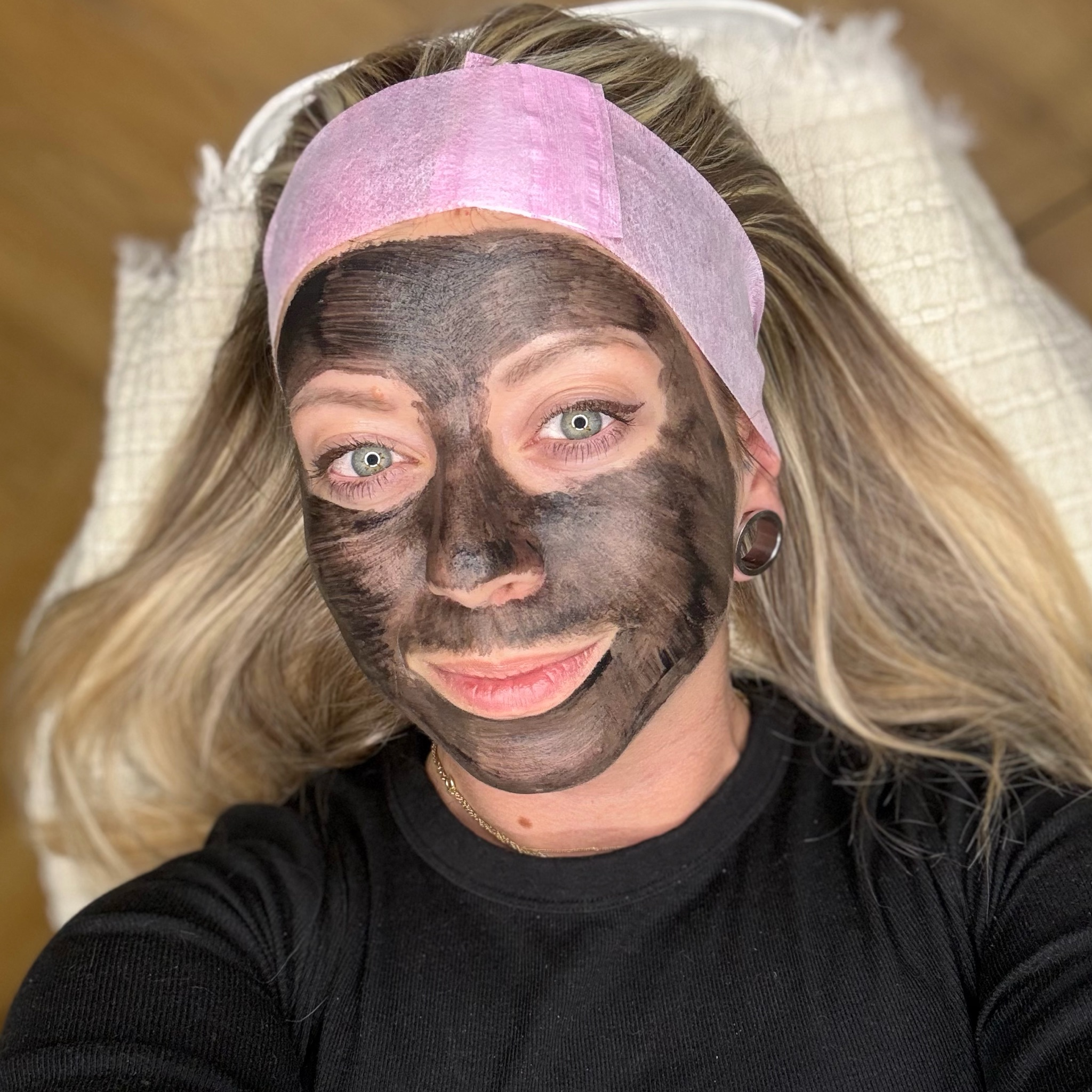 Carbon Peel 3 ošetření