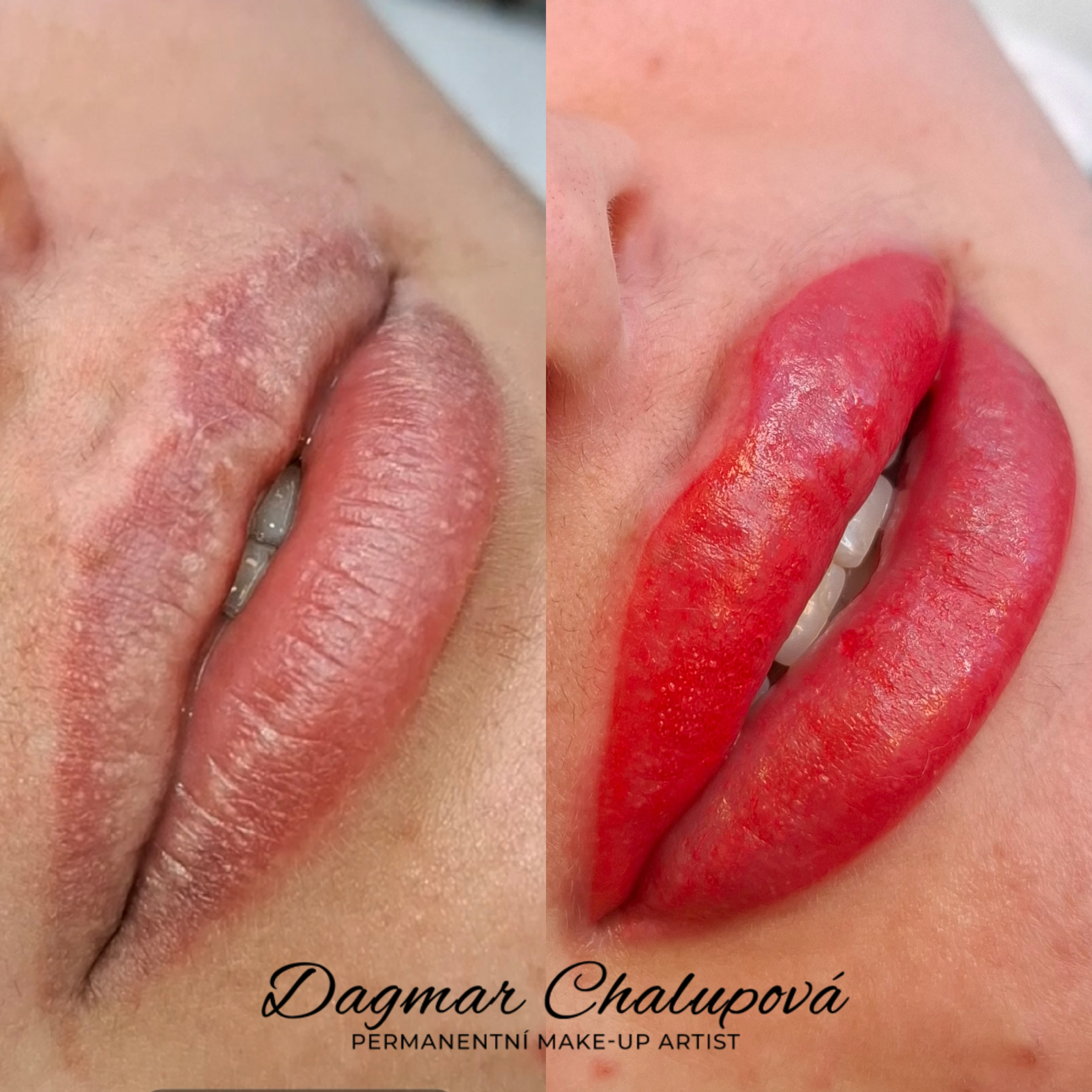 Korekce po první aplikaci - stínované rty (do 3 měsíců)