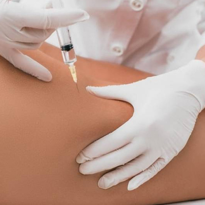 Redukcia tukových ložísk na tele