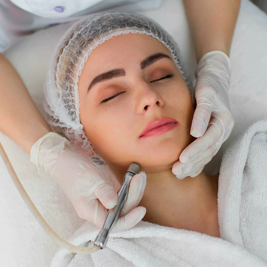 Diamant Microdermabrasion