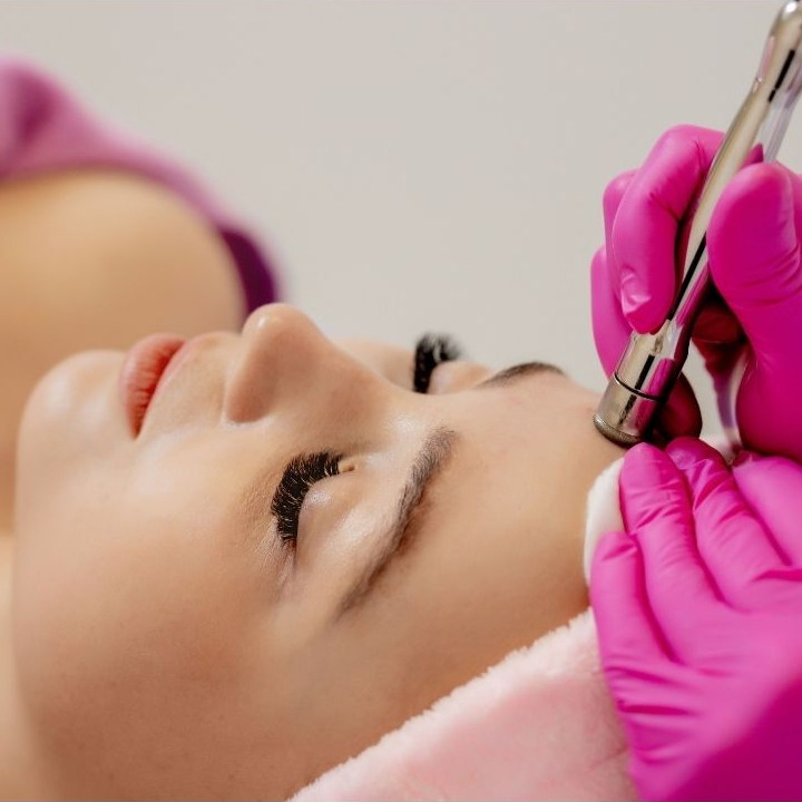 Microneedling
