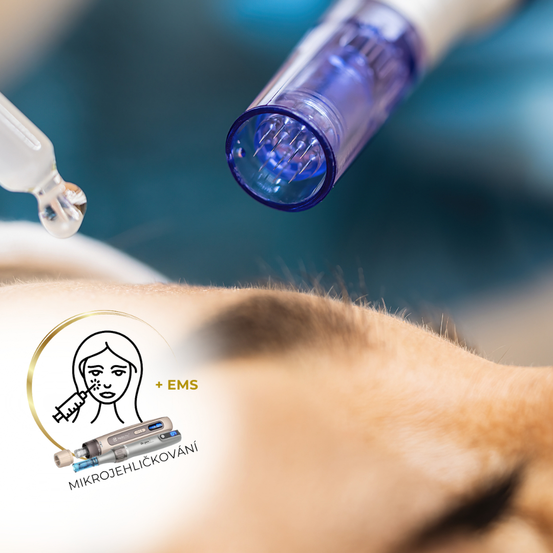 MIKROJEHLIČKOVÁNÍ - (obličej+krk+dekolt)
