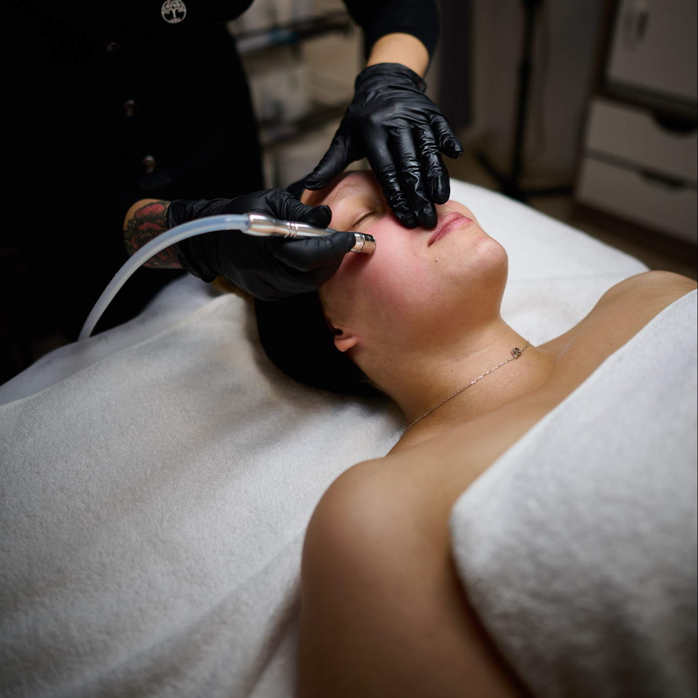 Diamantová mikrodermabraze