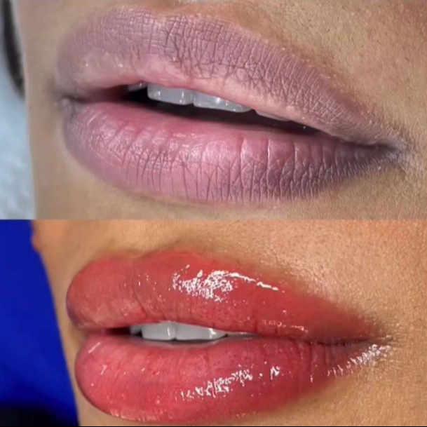Micropigmentação Natural Labial