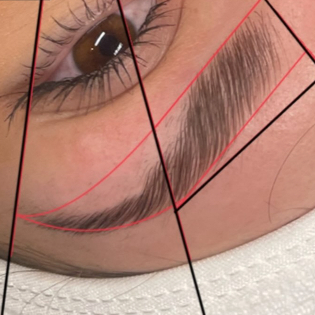 Restructuration + Épilation