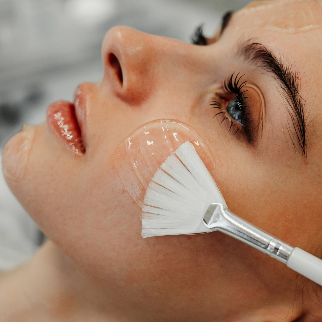 Chemický peeling – Regenerační péče 1 sezení