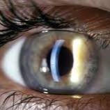 Annual Check-Up for Contact Lens Wearers