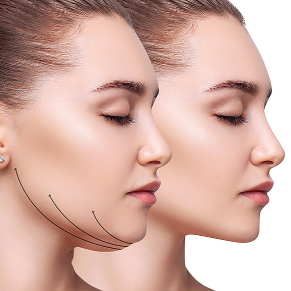 Injekčná lipolýza - Syslíky