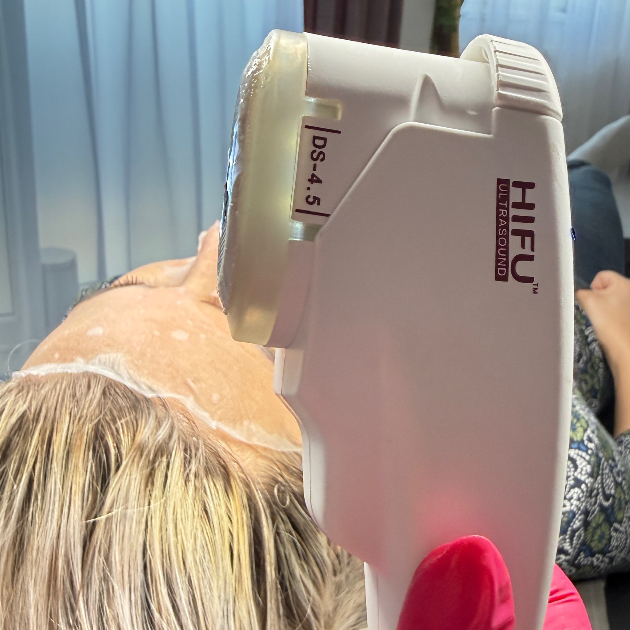 HIFU - Ultralift (celá tvár)