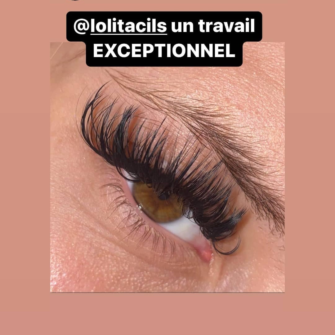 Remplissage Volume Russe 3 semaines