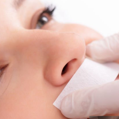 Epilace horního rtu