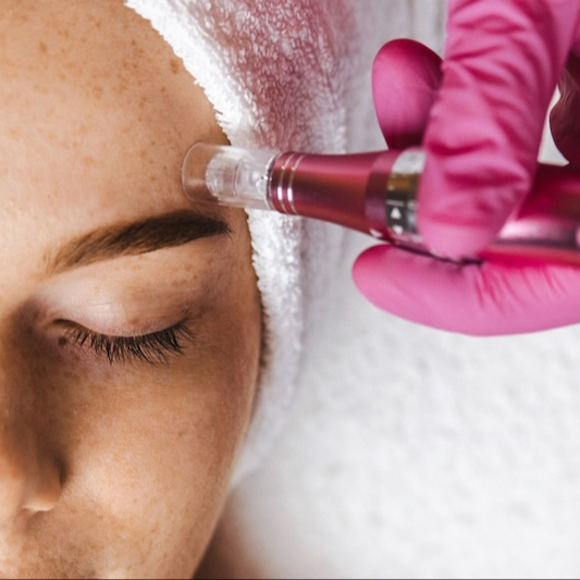 Microneedling Visage