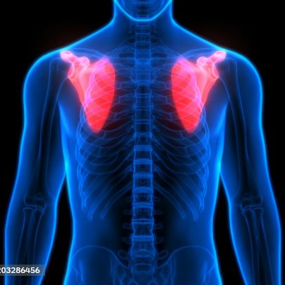 Schouderklachten therapie