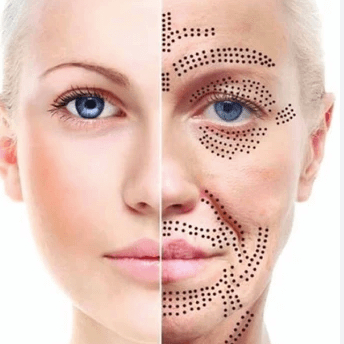 Plasma pen - mračivka