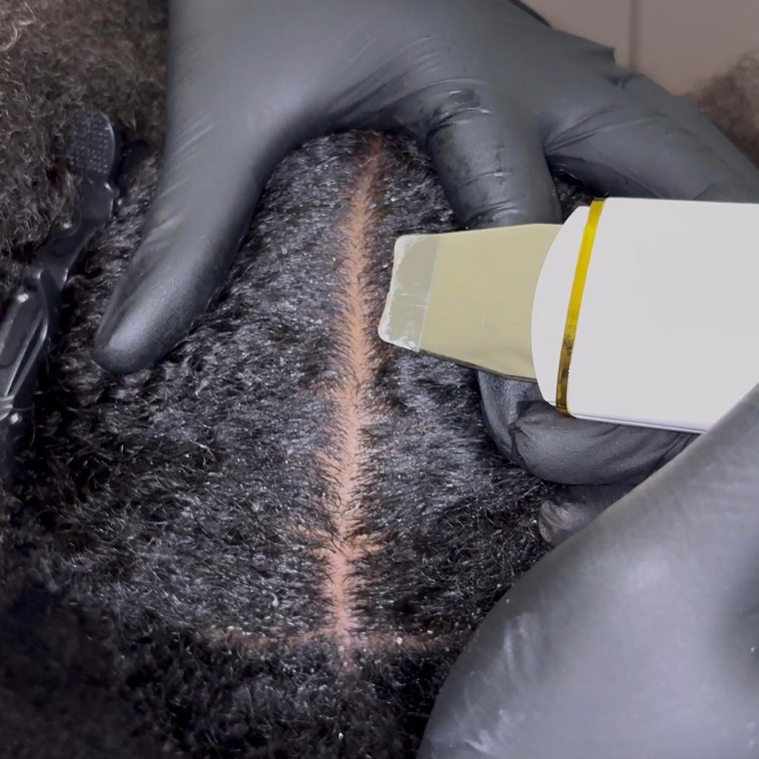 Scalp Détox Thérapy