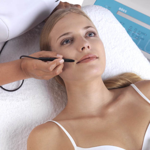 Expert: Elektroepilace / Electrolysis