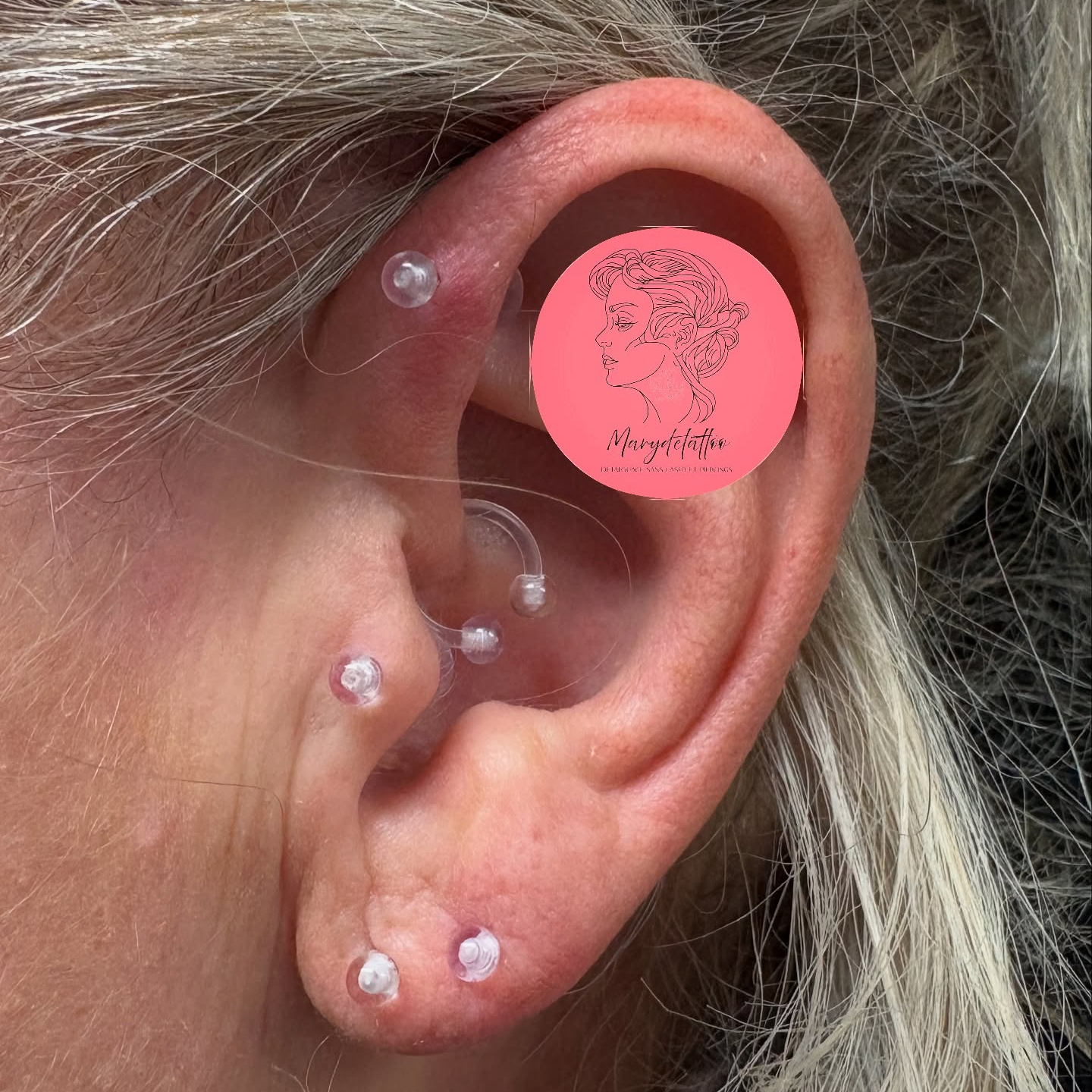 Forfait « Examen médical » avec bijou temporaire