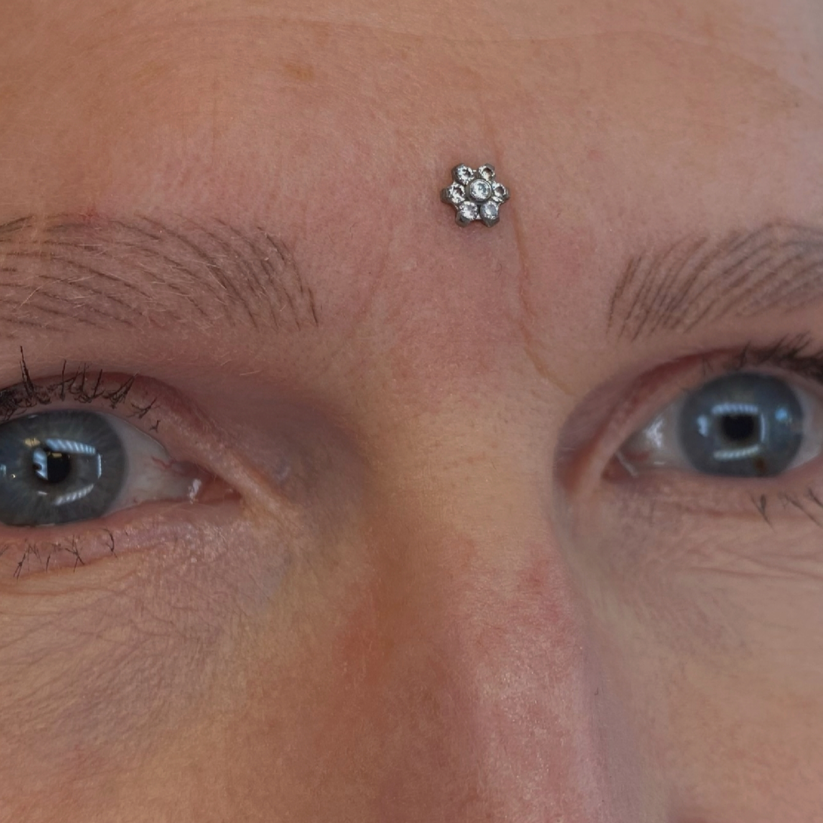 Microdermal(s)