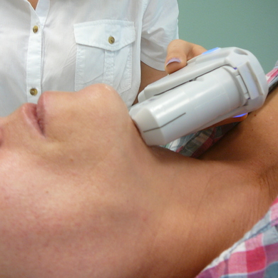 UltheraLIFT dolní část obličeje