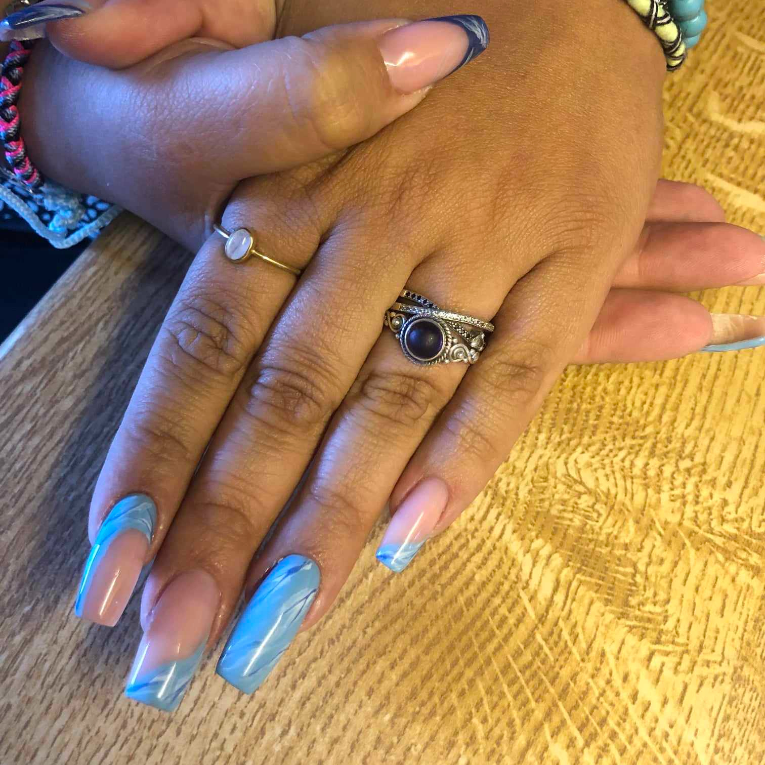 remplissage gel + 4 semaines