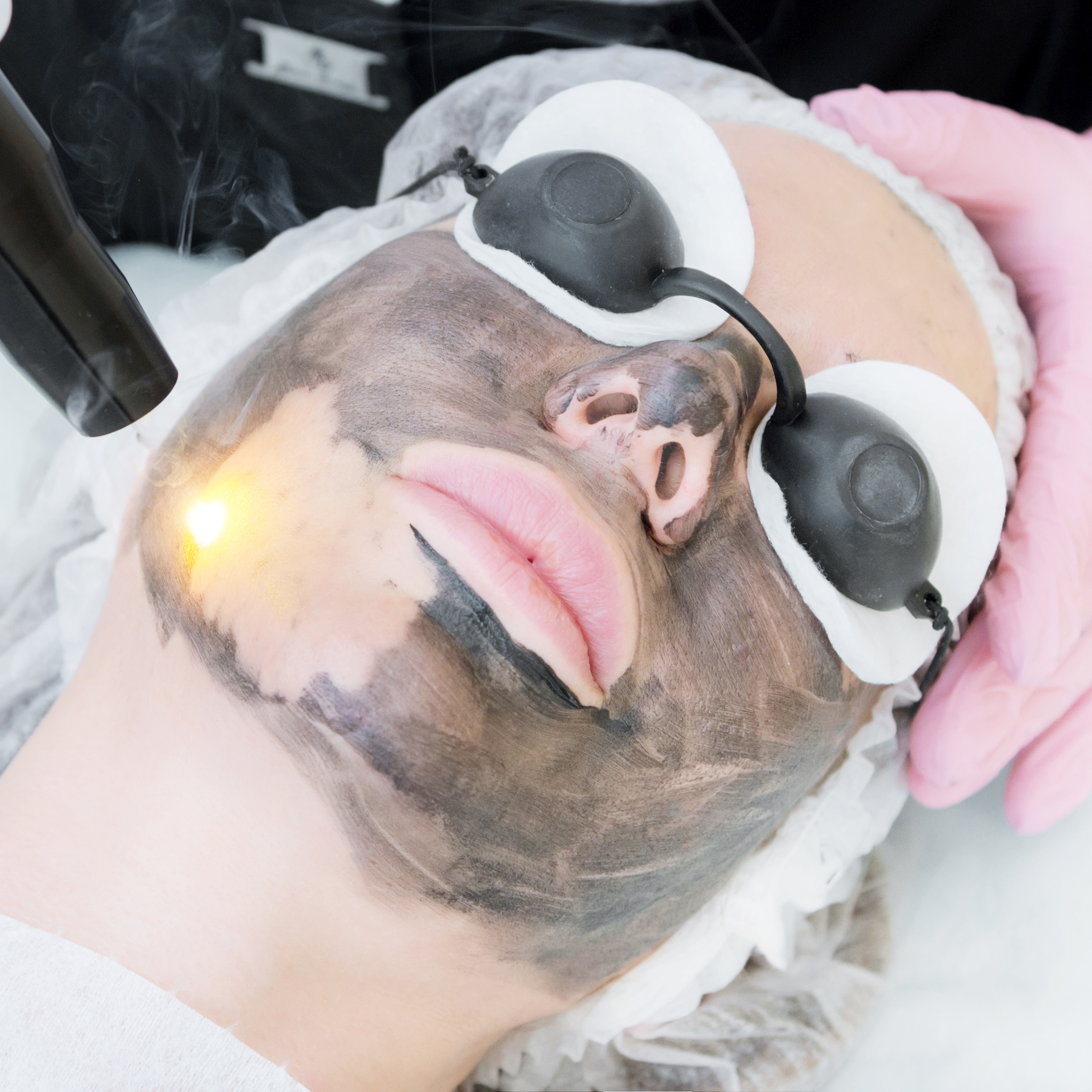 Carbon Peeling  Gesicht mit Hals ♀♂