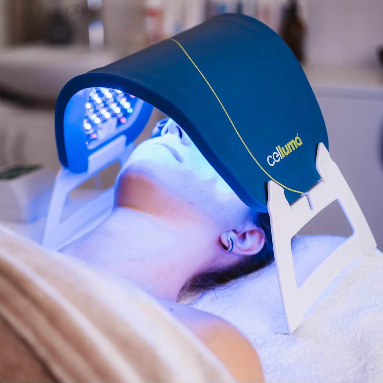 Mikrojehličkování / Microneedling