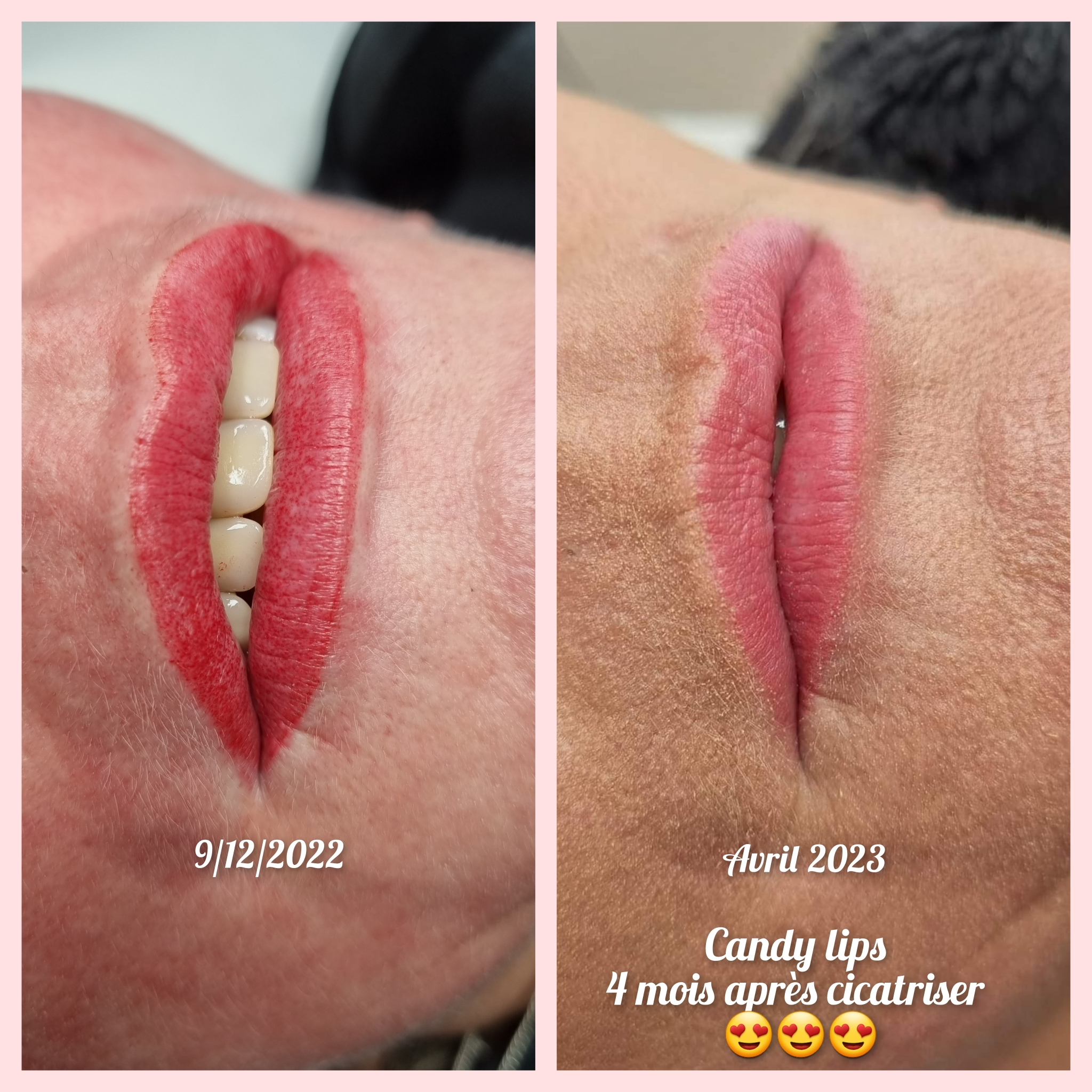 Lèvres, candy lips + contour