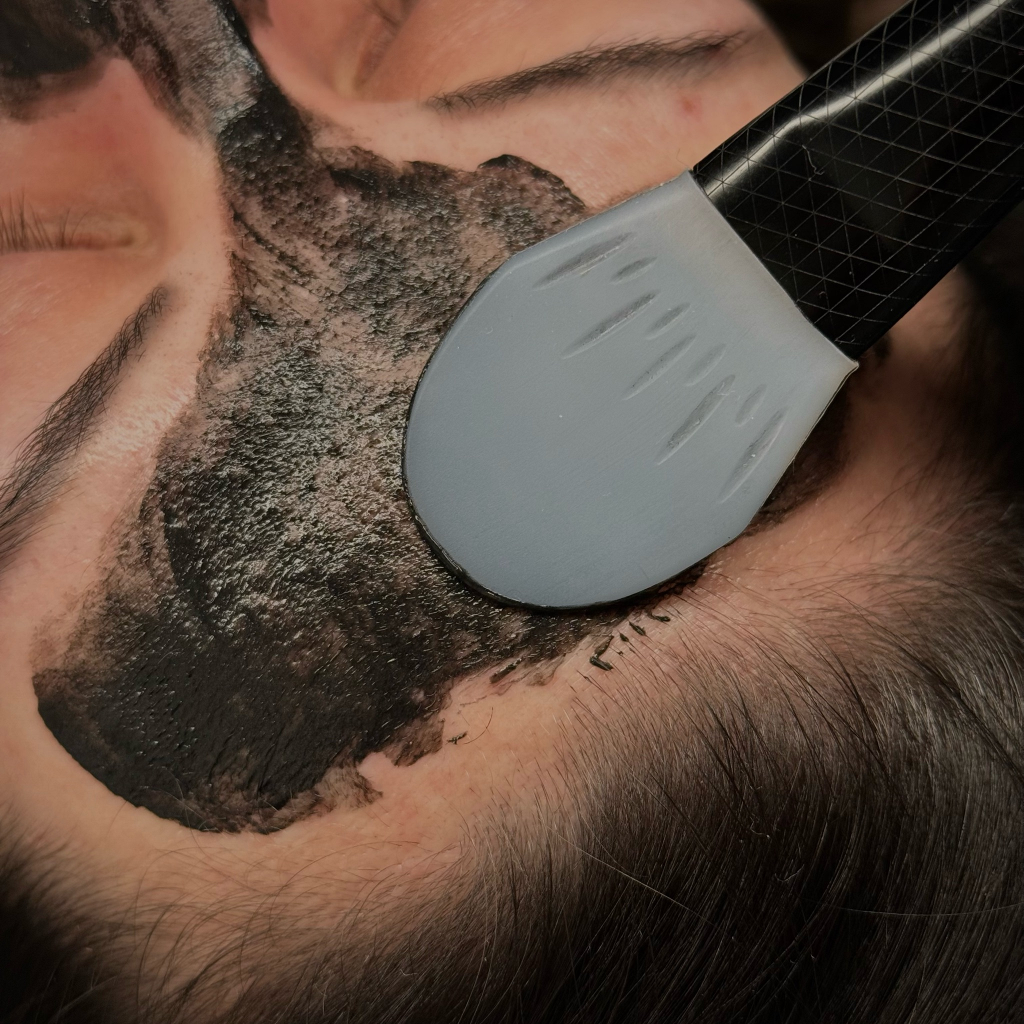 Karbonový peeling- 1500,-