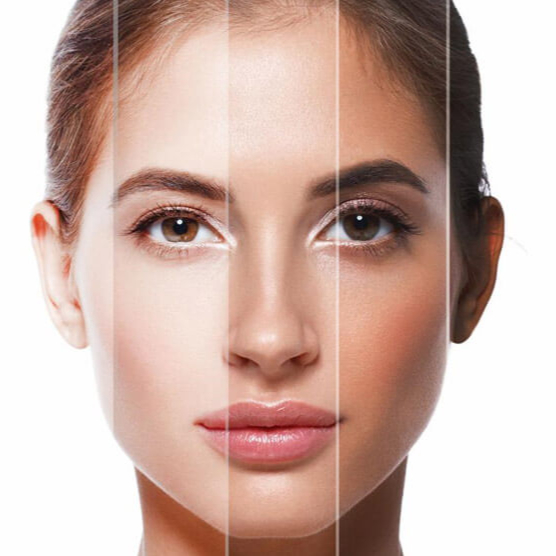 SMART sessão solario+colagéneo 18M