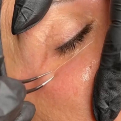 Lifting Coréen visage complet