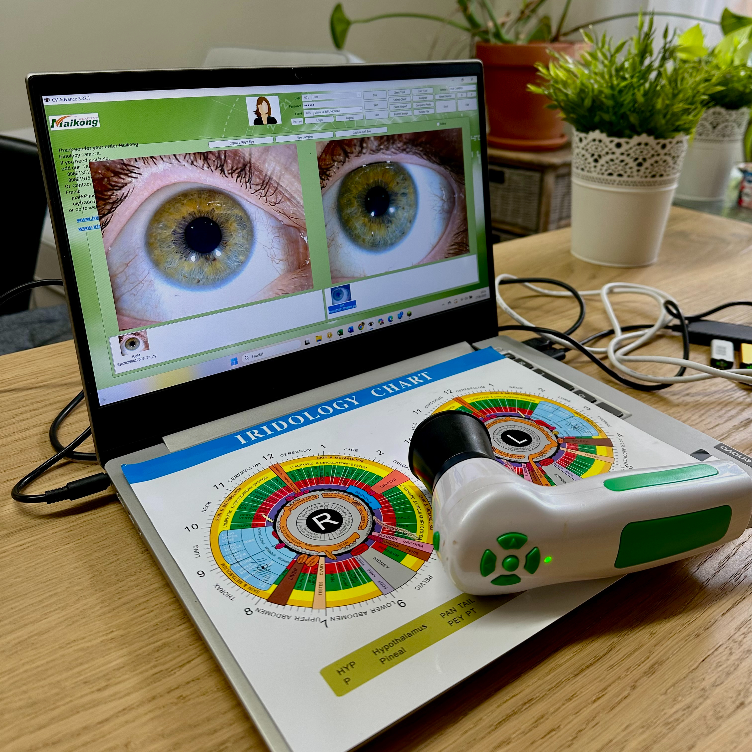 Odborné poradenství - Irisdiagnostika