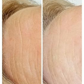 EXPRES LIFTING: ..rychlá, protivrásková regenerace GP 25+/ 950,-