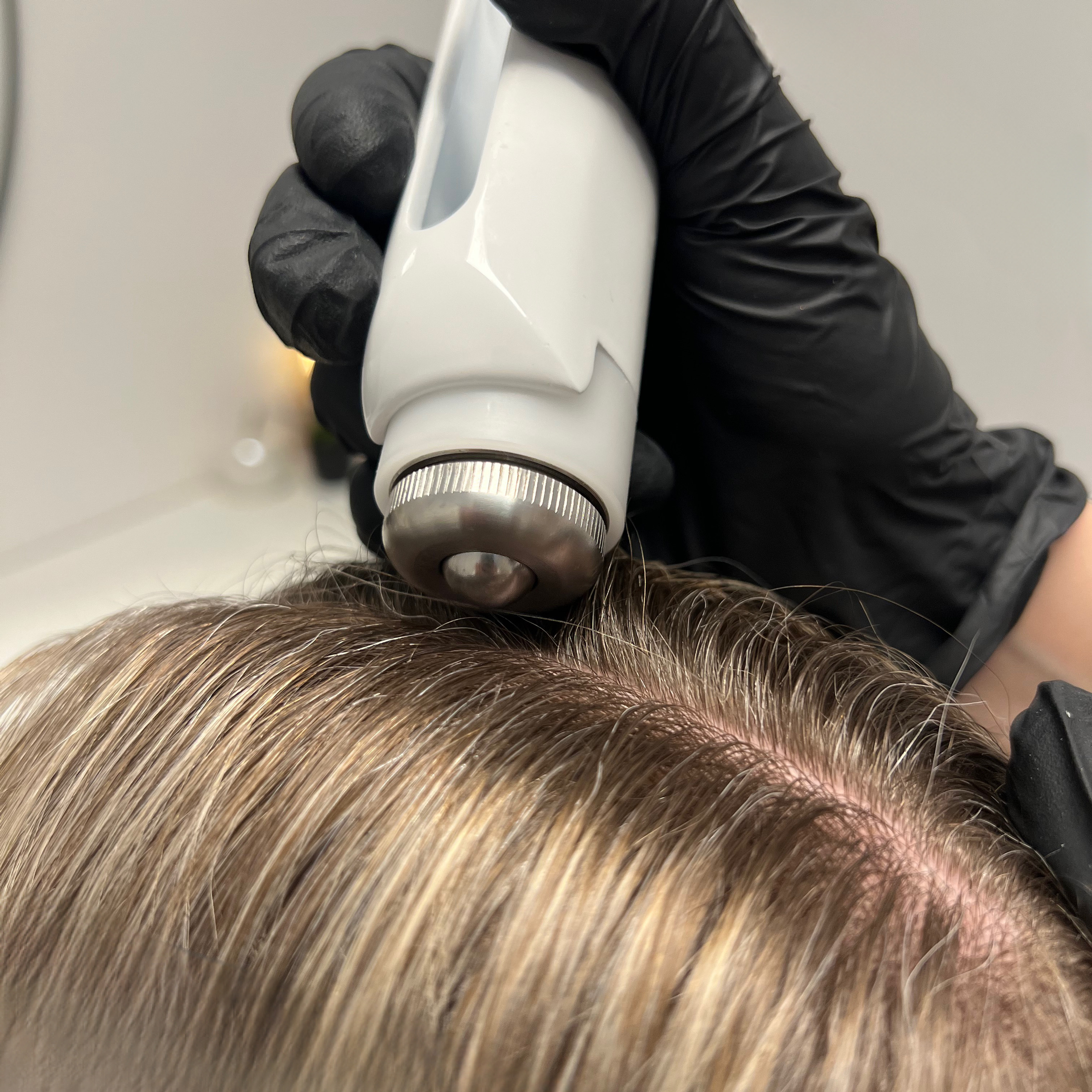 Čistenie pokožky hlavy a elektroporácia - sérum NEOHAIR