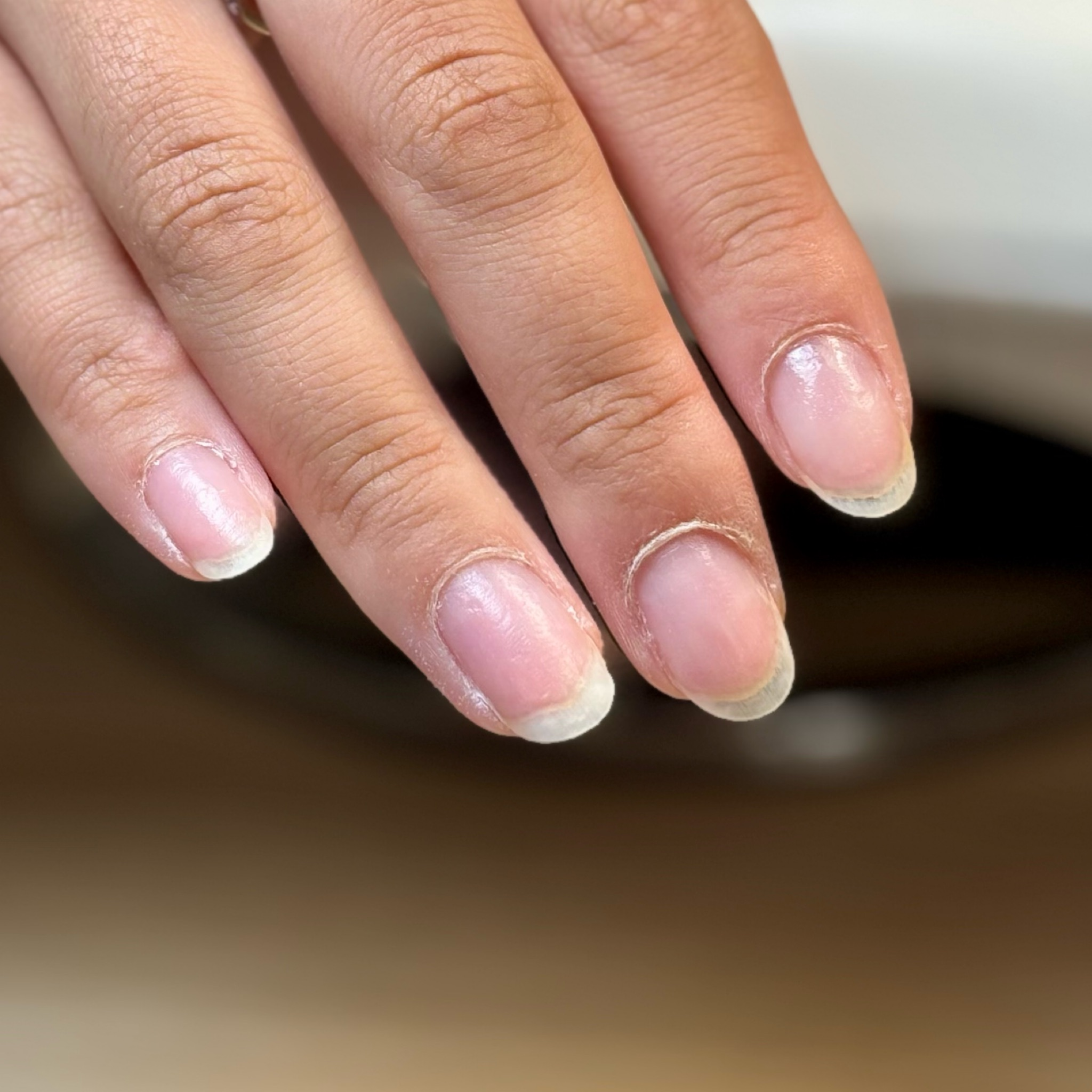 Dépose de gel (simple)