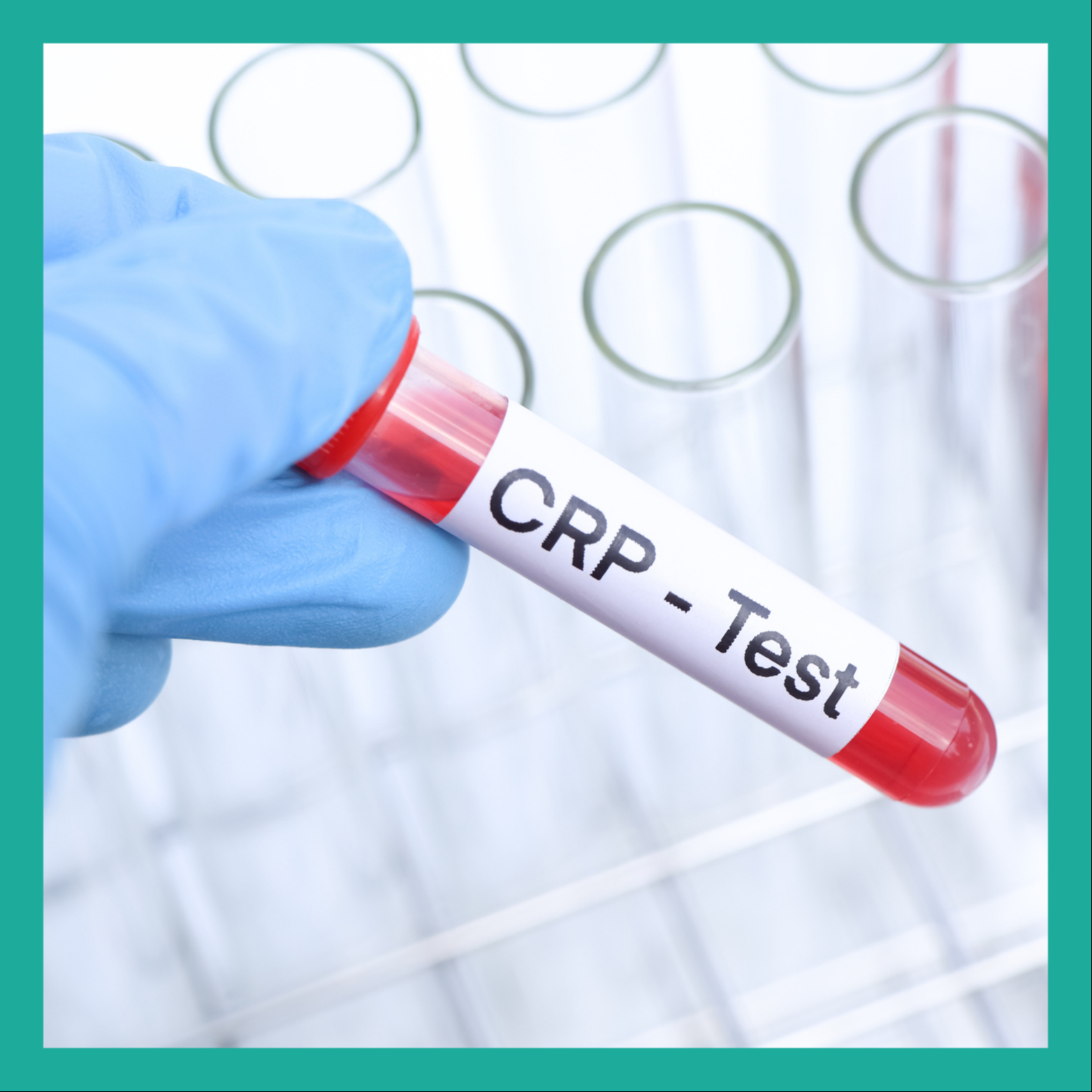 Meranie CRP (indikátor zápalu v tele)