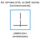 Polateszt Vizsgálat