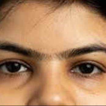 Epilation entre les sourcils "mono sourcils" 3mn