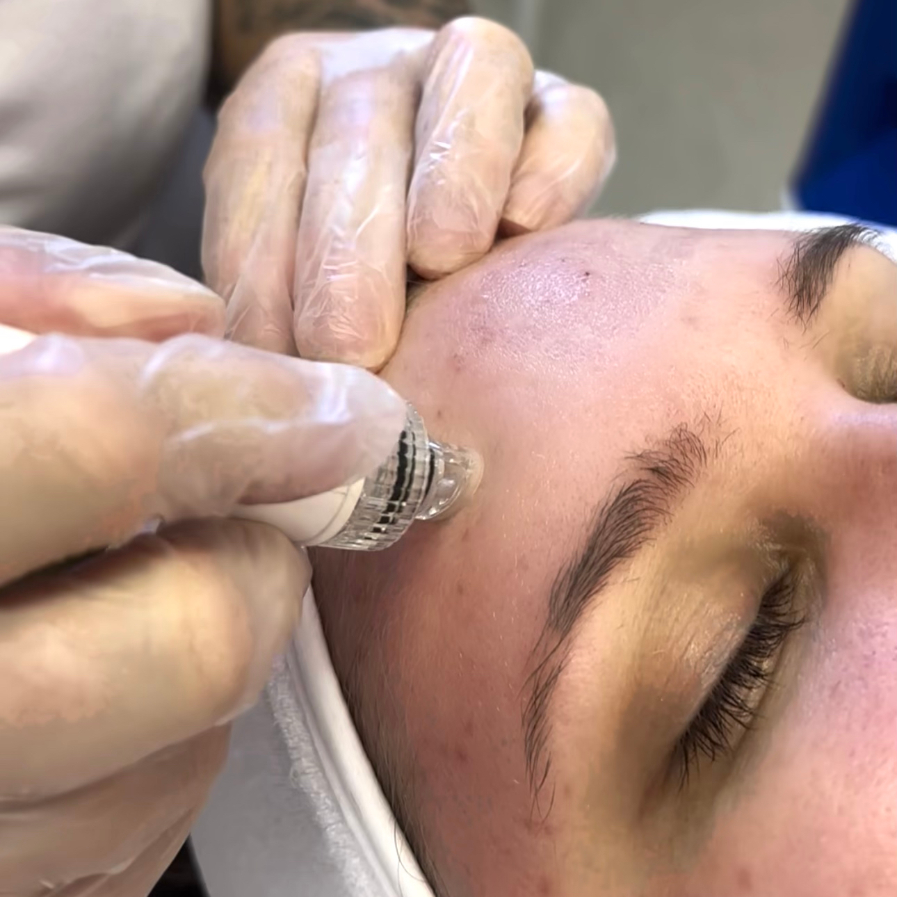 JANTÁR & KOLAGÉN RITUAL - infúzia mladosti.