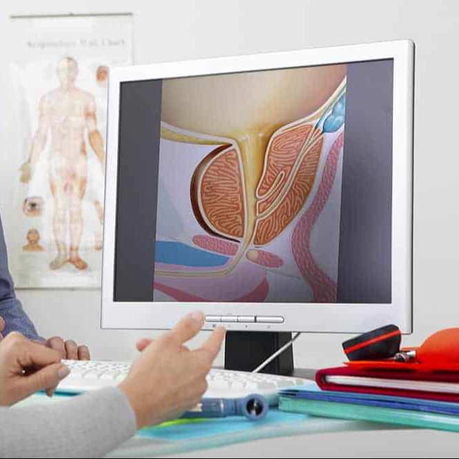Visita urologica con ecografia