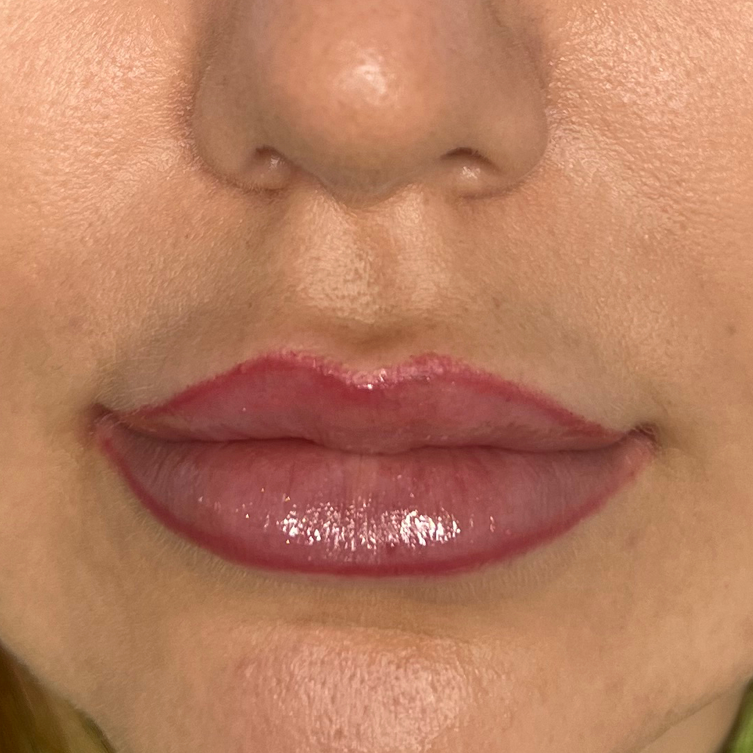 Hydra Lips