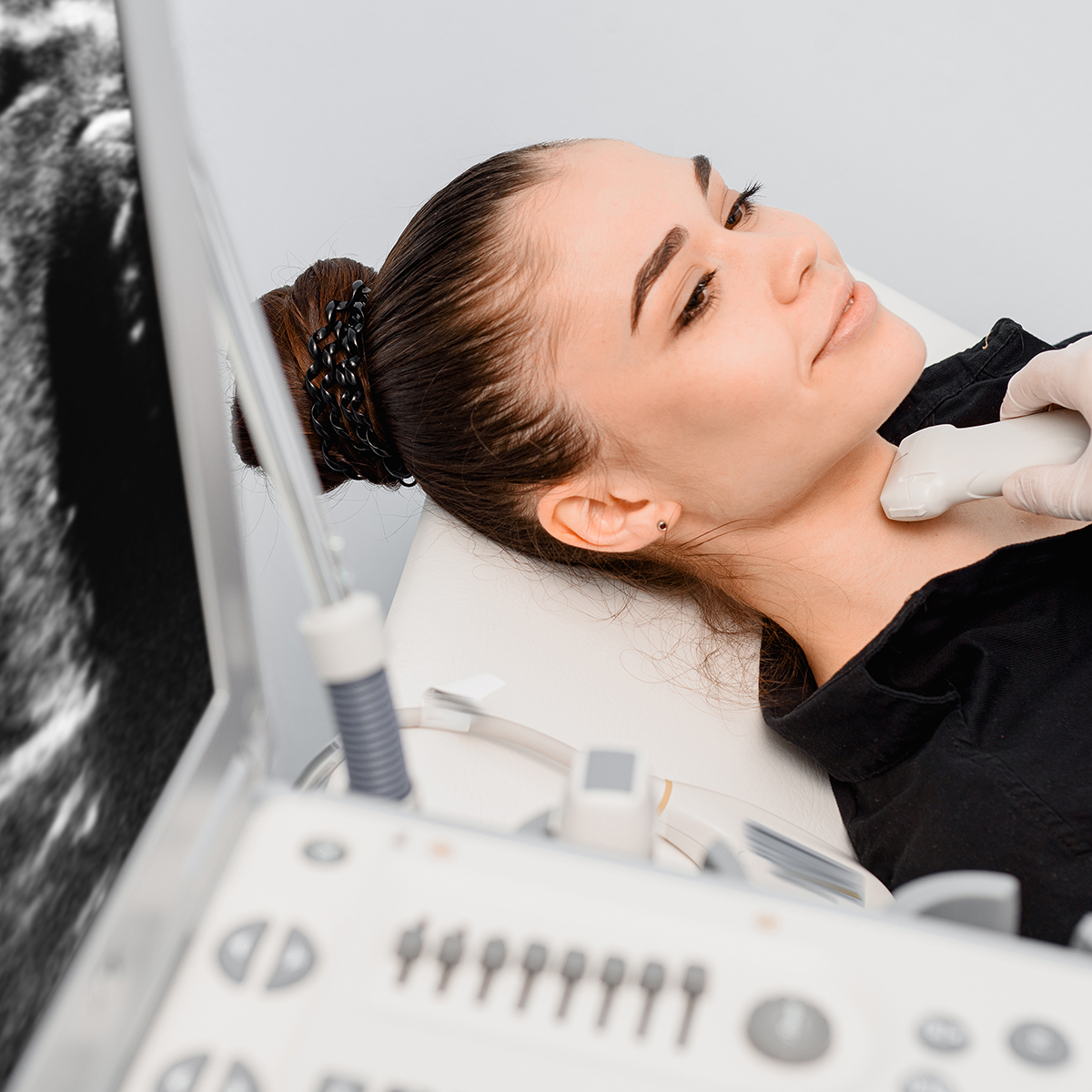 Ecocolordoppler tiroide