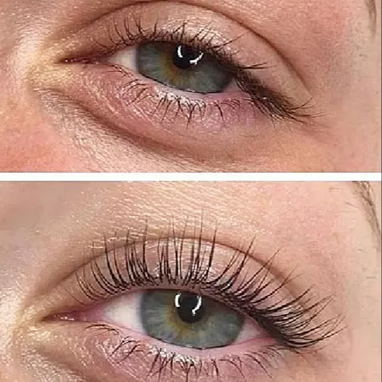 Lash Lifting & Lash Botox