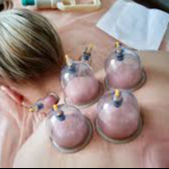 ventouses cupping thérapie