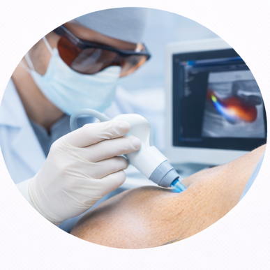 Asportazione con Laser CO₂ fino a 3 lesioni