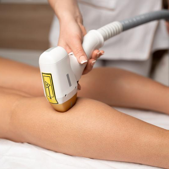 IPL epilace stehna nebo lýtka