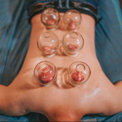 Massage aux ventouses