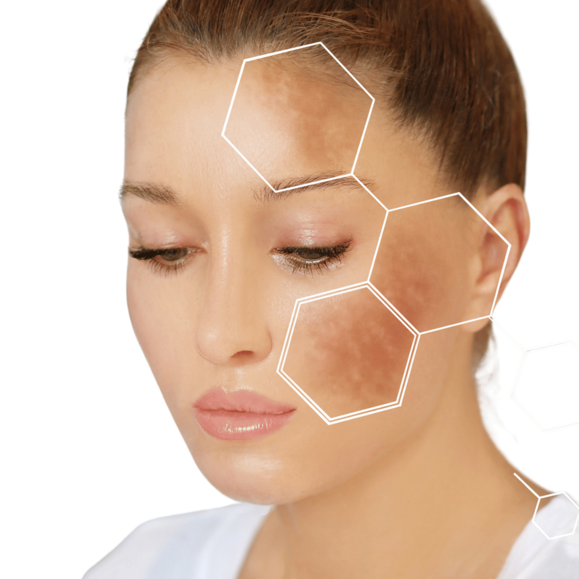 Nerovnomerná farba pleti